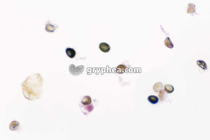 Taenia (ver parasite de l'Homme, Taenia saginata) - Oeufs extraits de déjections x40  - gryphea.org